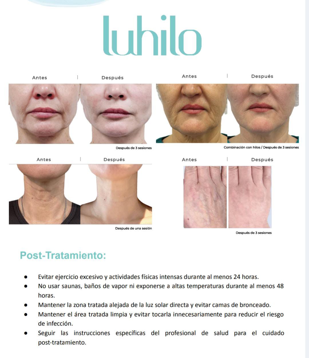 Luhilo